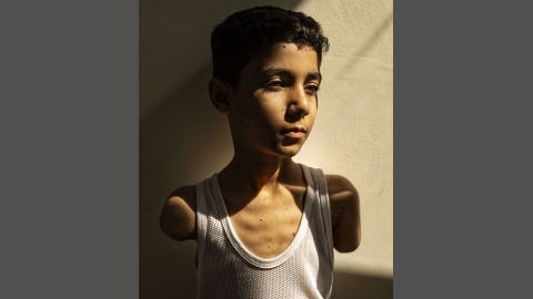 Foto van Palestijns jongetje zonder armen wint World Press Photo Foto van Palestijns jongetje zonder armen wint World Press Photo