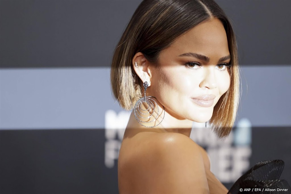 Chrissy Teigen heeft haarlijn laten verlagen Chrissy Teigen heeft haarlijn laten verlagen